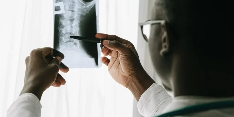 Close-up of a doctor examining a spine X-ray film with a pen in a hospital setting.